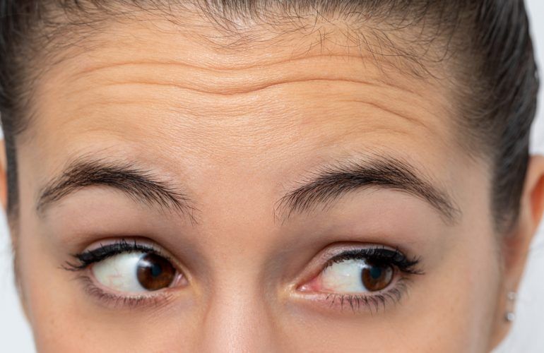 arrugas en la frente en Madrid